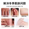 Creme Autêntico para Geada de Yunnan para Venda por Atacado, Creme para Geada Anti-Coceira, Creme Anti-Rachaduras, Creme para Geada para Mãos, Pés e Orelhas, Dropshipping