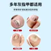 Caneta para Tratamento de Fungos nas Unhas, Protege e Nutre as Unhas, Não Precisa Remover as Unhas, Reparo de Unhas Atacado e Dropshipping