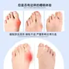 Separador de Dedos del Pie con Superposición de Pulgar Ajustable Protector de Dedo Pulgar de Silicona Corrector Ortesis para Corrección del Dedo Meñique