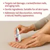 Solución para el Cuidado de Uñas Transfronterizo 15ml Empaque Neutro