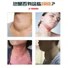 Parches Externos para el Cuidado de la Salud Tipo Tiroides, Parches para el Cuidado del Cuello de Uso Doméstico, Parches para el Cuidado Calmante del Cuello, Parches Transdérmicos Externos al por Mayor