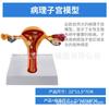 Modelo de Molde Reproductivo Femenino Modelo de Molde Reproductivo Femenino Modelo de Útero Privado Materiales Didácticos Anatomía Ginecológica Ovárica