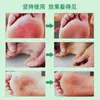 Qiaofusheng Spray Refrescante para Pies Set de Sprays para el Cuidado de los Pies Líquido para el Sudor de Pies Cuidado Externo de la Salud Fabricante Venta al por Mayor