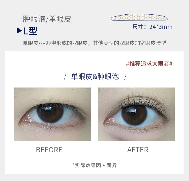 OK绷双眼皮贴_13