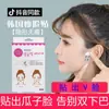 Atacado Patch Japonês para Sulco Nasogeniano Invisível Pequeno Rosto em V Afinando Fita Transparente Fosca Super Aderente Patch Lifting Facial Patch Afinando o Rosto