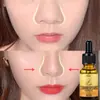 Líquido nasal 10ml aceite esencial para masajear la nariz aceite esencial para el cuidado de la nariz