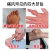Dor. Adesivo para Dor nas Mãos e Pés, Inchaço, Dormência, Ácido Úrico, Gota, Dor nas Mãos e Pés, Acúmulo de Ácido Urinário, Adesivo para Protuberância de Cristal