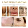 Eelhoe Esencia de Cuidado de Cúrcuma Cuidado Facial Hidratante Humectante Suave Nutritivo Esencia para el Cuidado de la Piel