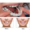 Loja de Suprimentos Atacadistas de Aparelhos Dentários de Silicone de Segunda Geração para Dentes Superiores e Inferiores de Casa Prótese Dentária Aparelhos Dentários Dropshipping