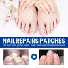 Patch Ximonth para Cuidado das Unhas, Unhas Macias e Bem Cuidadas para Mãos e Pés, Confortável, Fresco, Respirável e Adequado para Cuidado
