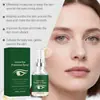Spray Protetor para os Olhos, Refrescante e Hidratante, Suave e Hidratante, Cuida da Pele Delicada e Macia ao Redor dos Olhos, Spray Confortável