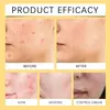 Beevenom Crema para el Cuidado de la Piel con Veneno de Abeja Crema Suave Acondicionadora y Nutritiva para una Piel Suave y Tersa