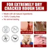 Jaysuing Mascarilla de Ácido Frutal para Cutícula y Pies Cuidado de los Pies Hidratante Hidratante Rejuvenecedora Hidratante Mascarilla para Pies