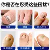 Fungo de Unha Cinza Girassol, Unhas Quebradiças e Rachadas, Creme de Limpeza e Remoção da Superfície da Unha, Unhas Amareladas Espessadas, Fungo de Unha Cinza, Solução Cinza para Unha Quebradiça