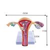 Modelo patológico uterino femenino estructura uterina ovárica materna y reproductiva Anatomía simulación avanzada modelo uterino mórbido