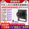 Câmera de Rede Poe Quadrada de Metal Grande Grande Angular 170 Graus Panorâmica Olho de Peixe 1.8mm 4 Milhões 5 Milhões Xiongmai