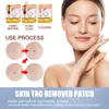 Patch Invisível para Acne Qingpu Exclusivo Transfronteiriço, Patch para Cicatrizes, Patch para Remoção de Verrugas para Fácil Aplicação de Maquiagem