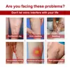Crema para el Cuidado de las Venas South Moon Masajeador de Piernas Alivia el Dolor y Repara las Várices Crema para el Cuidado Corporal
