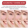 Parche para el acné OUHOE, cuidado facial, limpieza suave, atenúa la piel con acné, parche portátil multiforma para el acné.