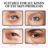 Jaysuing Barra de Crema para Ojos con Retinol Aclara Ojeras, Bolsas en los Ojos y Líneas Alrededor de los Ojos, Cuida la Zona del Contorno de Ojos