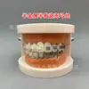 Modelo ortodóntico dental modelo de cermet oral autoblocante pantalla de comunicación médico-paciente ambulatoria modelo de enseñanza dental