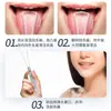 Nuevo raspador de lengua para el hogar con luz, limpiador de lengua iluminado, limpiador de lengua oral, herramienta de limpieza bucal para raspar la placa lingual