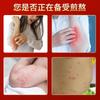 Crema Miaojiang Baicao para la Piel Anti-Picazón Reparadora Alivia la Picazón y Descamación de la Piel Tiña de Manos y Pies Crema para el Cuidado Anti-Picazón Venta al Mayoreo