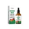 Hoegoa Cuidado del Cabello Aceite de Batana Nutre el Cabello, Suaviza el Cabello, Fortalece el Cabello y Proporciona Aceites Esenciales para un Cabello Saludable