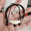 Pulseira Autêntica de Dente de Cão Preto Pulseira para Adultos, Crianças e Bebês, Pulseira de Corda Vermelha Portátil Anti-Choque para Mão e Pé
