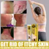 Crema reparadora de piel transfronteriza manchas musgo manchas de sudor ungüento tópico crema para picazón de piel venta al por mayor