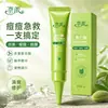 Naipai Creme para Acne com Ácido Mandélico Controle de Oleosidade Suaviza Cicatrizes de Acne Regula Acne Recorrente Refrescante Adstringente para a Pele Gotas de Controle de Oleosidade Dropshipping