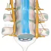 Zm1142 Coluna Vertebral e Nervos Espinhais Modelo Ampliado da Coluna Vertebral com Medula Espinhal e Nervos Espinhais