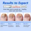 Caneta Popular Transfronteiriça para Unhas para Remover Cutículas, Prevenir Rachaduras, Óleo para Borda da Unha, Cuidados com as Unhas, Ferramenta Hidratante para Unhas