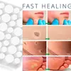 Adesivos Transfronteiriços para Remoção de Verrugas de Pele, Adesivos Clareadores de Verrugas de Pele, Adesivos para Remoção de Verrugas, Adesivos Removedores de Verrugas de Pele com Processamento OEM