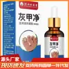 Tratamiento para Onicomicosis 30ml/botella, para uñas negras en capas y descamadas, producto popular de comercio electrónico, regalo promocional