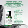 Transfronteiriço Rsmhrq Spray de Vitamina para Crescimento Capilar Líquido Nutritivo para Cabelo Spray de Vitamina para Crescimento Capilar
