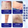 Crema para Cicatrices, Aplicación Roll-On, Hiperplasia de Cicatriz Portátil, Cicatriz de Mano, Cicatriz de Pierna, Compresa de Agua Calmante Herbal