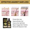 Jaysuing Champú para el Cuidado del Cabello de Jengibre Limpieza Profunda del Cabello Hidratante Cuidado del Cabello Hidratante Suave y Esponjoso