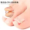 Parche en forma de X de aleación de níquel para uña encarnada, estiramiento físico para el surco ungueal y uñas ongling, compacto e invisible, permite caminar mientras se usan zapatos, parche para enderezar la uña