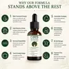 Sérum para el cuidado de las uñas con aceite esencial de árbol de té y jengibre, 7 días, transfronterizo, 30 ml, empaque neutro