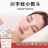 Parches para Líneas de Expresión en Stock para Mejorar las Líneas de Expresión Faciales, Surcos Nasogenianos, Patas de Gallo y Arrugas de la Frente