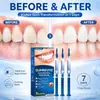 FACNURT Gel Reparador Periodontal Cuidado Suave de las Encías Limpieza Bucal Diaria Aliento Fresco Esencia Dental Transfronterizo