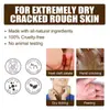 Creme para Calcanhar Rachado South Moon Cuidado Suave para os Calcanhares Creme Hidratante Leve para Uso Diário