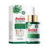 Esencia anti-acné SADOER completa productos para el cuidado de la piel con acné esencia facial hidratante anti-acné comercio exterior transfronterizo venta al por mayor