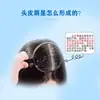 Shikangwang Aceite para el Cuero Cabelludo Anti-Picazón y Anti-Caspa Reparador de Ácaros Champú Crema Refrescante Control de Grasa Picazón del Cuero Cabelludo Champú Genuino