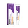 Crema Reparadora con Ácido Azelaico Mes de Occidente Desvanece el Acné Reparación Suave Piel del Rostro Crema Inteligente