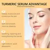 Esencia Hidratante de Cúrcuma Ouhoe Facial Hidratante Hidratante Refrescante Ligera Esencia Hidratante para Piel Seca y Sedienta
