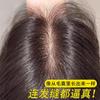 Peruca de agulha de entrega total cabelo real leve respirável capa de cabeça cabelo branco fofo alto topo craniano substituição de cabelo fábrica atacado