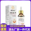 Atacado do Fabricante Yunnan Ervas Cinzas Unha da Mão Unha do Pé Solução para Cuidados com a Saúde 30ml Dropshipping