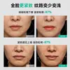 Masajeador Facial de Relajación con Pulsos EMS con Control Remoto, Uso en Casa, Masajeador de Microcorriente, Mascarilla, Vendaje de Lifting, Reafirmante y Moldeador